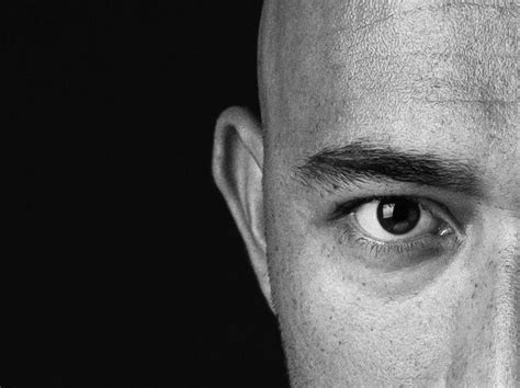 Scalp Micropigmentation Regrets: 6 Prevention Tips.